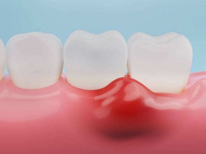 Tlhaloso ea toro ka marenene a ruruhileng