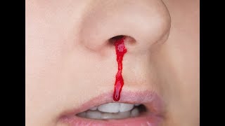 تفسير حلم الدم من الانف