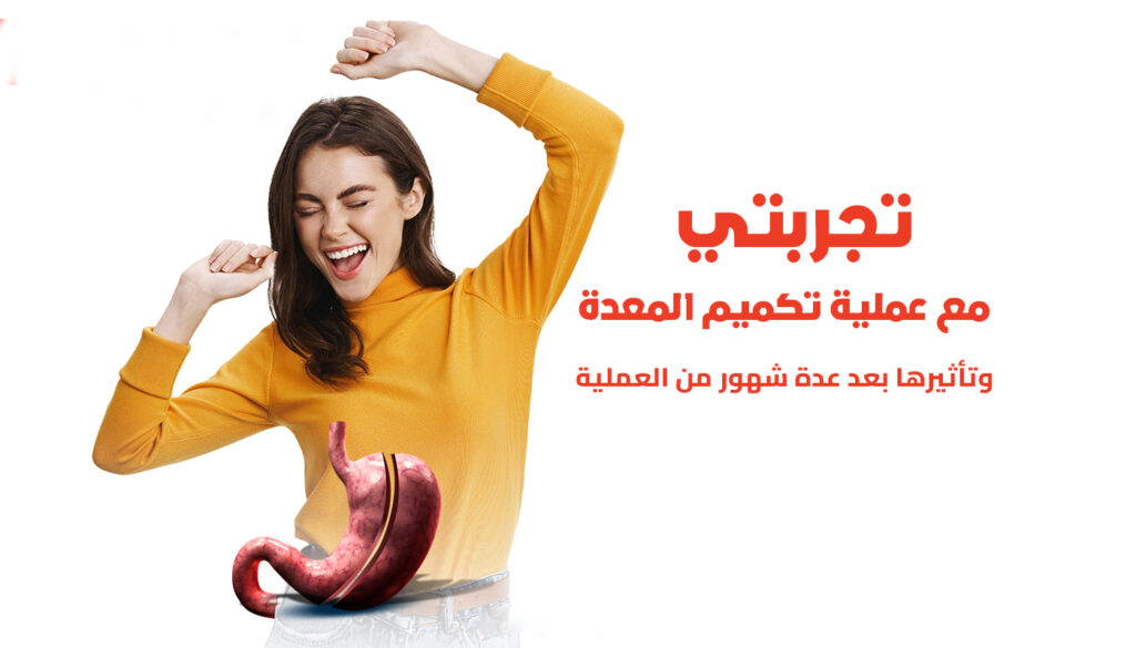 تجربتي مع عملية التكميم