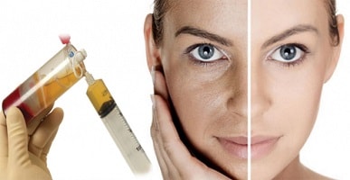 حقن البلازما للوجه تجربتي 