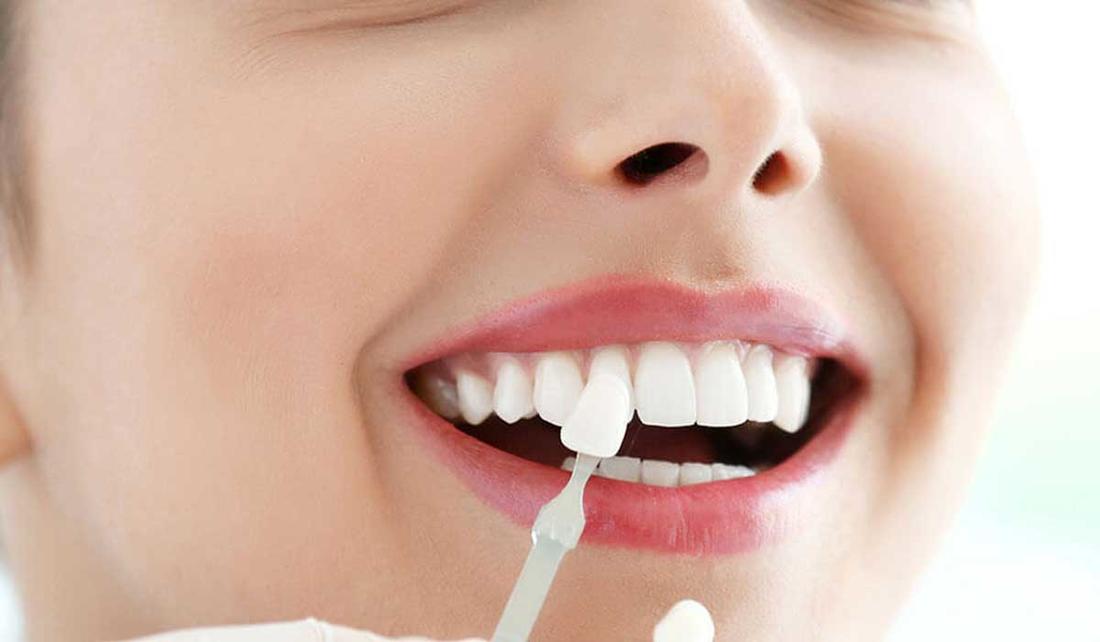 تفسير حلم سقوط الأسنان للعزباء