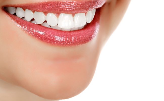 سفید کردن دندان در خواب