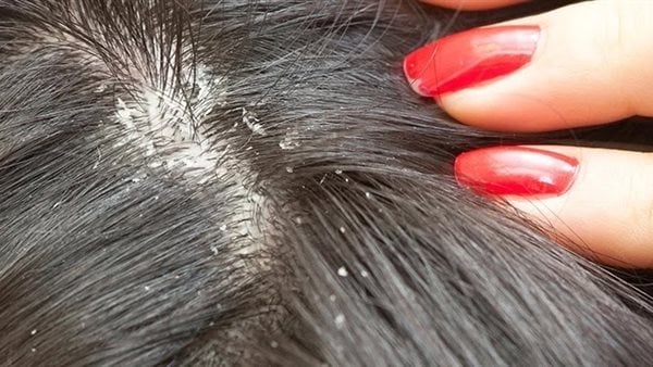 الصيبان في المنام