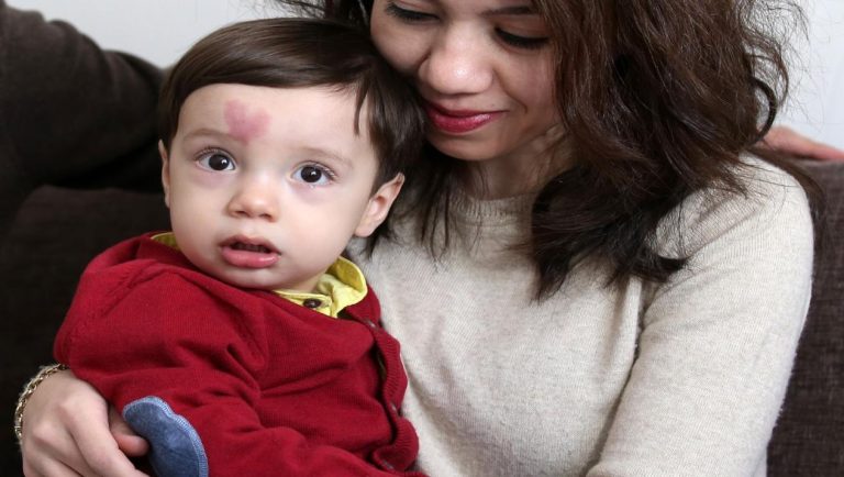 الحلم بطفل مشوه